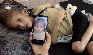 Gazze’de açlıktan şehit olanların sayısı 457’ye yükseldi