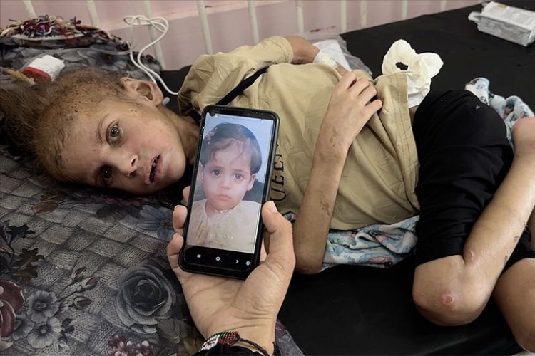 Gazze’de açlıktan şehit olanların sayısı 457’ye yükseldi
