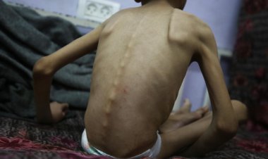 Gazze'de açlık nedeniyle şehit sayısı 460’a yükseldi