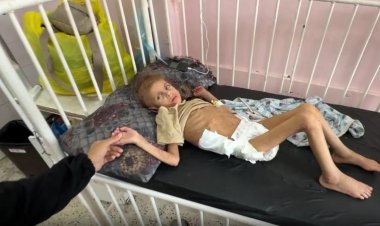 DSÖ: Gazze'de son 2 ayda 10 bin çocuğa akut yetersiz beslenme teşhisi konuldu