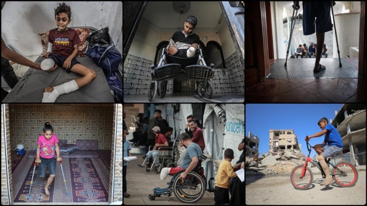 Gazze’de 6 bin ampute, soykırımcı İsrail’in saldırılarının ardından yaşam mücadelesi veriyor