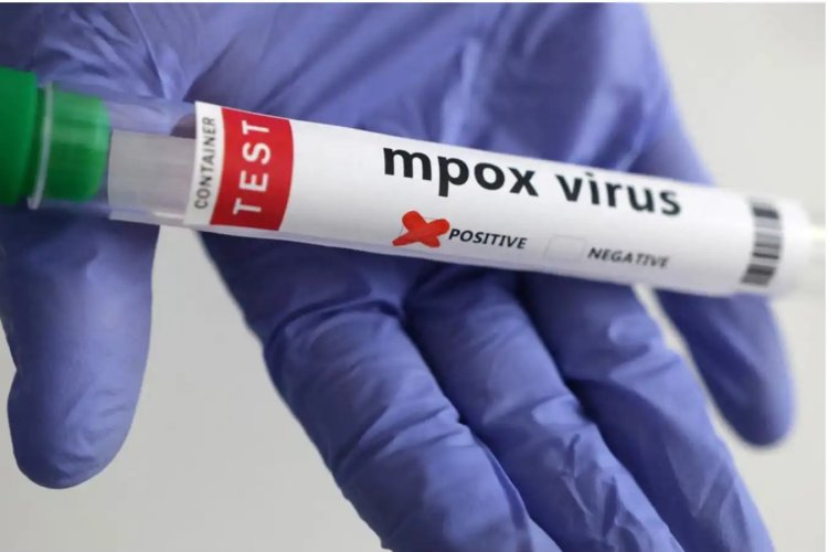 İngiltere’de mpox virüsünün yeni bir türü tespit edildi