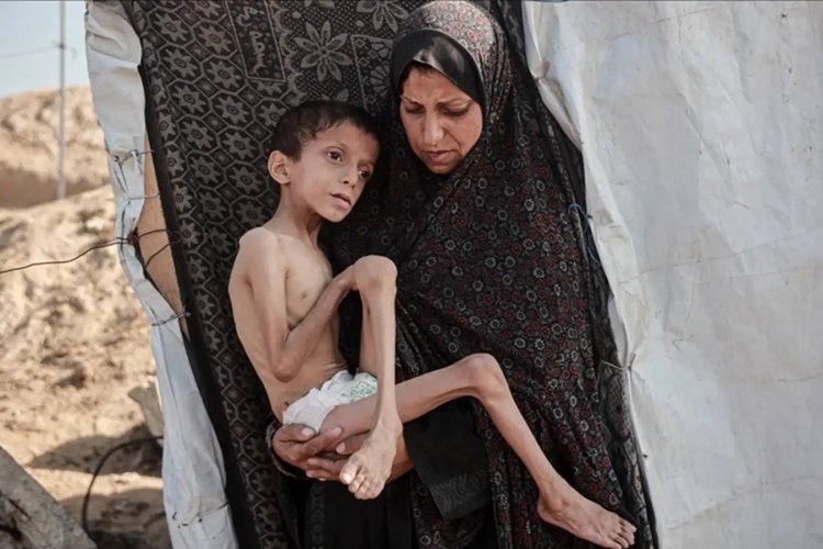 BM: Gazze'de akut yetersiz beslenme vakaları 95 bine dayandı