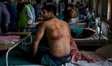 Direnişçilere katılanların ailelerine yapılan acımasızca işkenceler