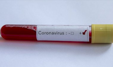 Myanmar'da ilk Kovid-19 vakaları görüldü