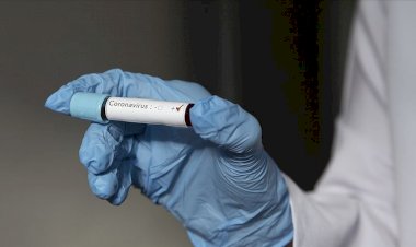 Brezilya'da Kovid-19 ilaç testi deneklerin ölümünün ardından yarıda kesildi